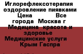 Иглорефлексотерапия, оздоровление пиявками › Цена ­ 3 000 - Все города, Москва г. Медицина, красота и здоровье » Медицинские услуги   . Крым,Гаспра